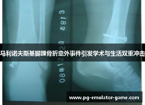 马利诺夫斯基脚踝骨折意外事件引发学术与生活双重冲击 马利诺夫斯基脚踝骨折意外事件引发学术与生活双重冲击